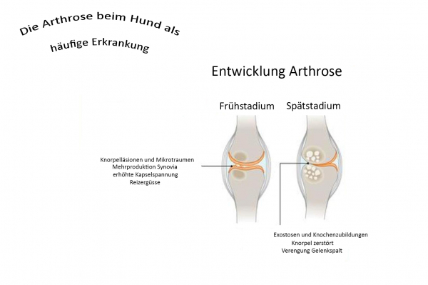 Arthrosenentwicklung