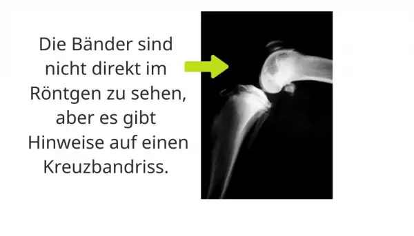 Leider keine Seltenheit: ein Kreuzbandriss bei Hunden